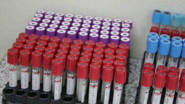 Роспотребнадзор передал тест-системы для исследования коронавируса в 13 стран
