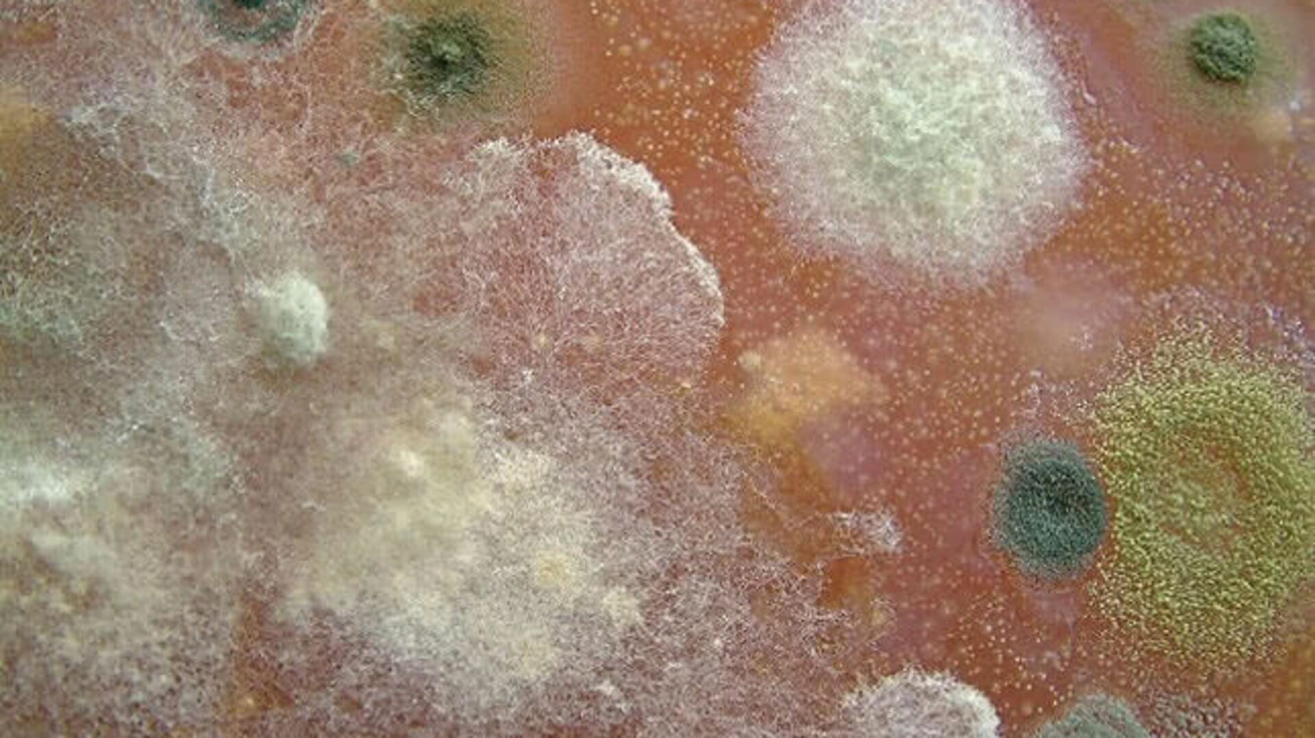Пятна плесени. Плесневые микозы. Плесневелый грибок на коже. Грибок кожи под микроскопом.
