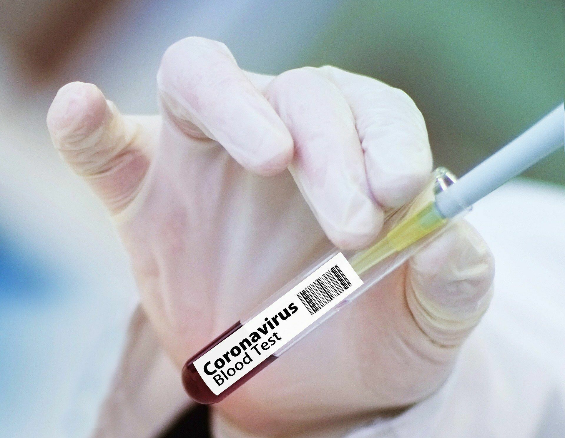 Количество проводимых тестов на коронавирус в сутки растет в Карелии